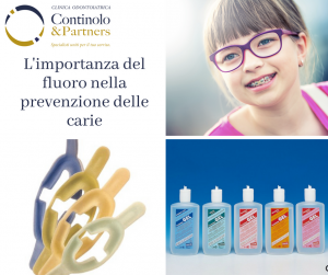 Fluoro e prevenzione della carie | Continolo & Partners