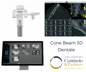 Cone Beam 3D | Continolo & Partners